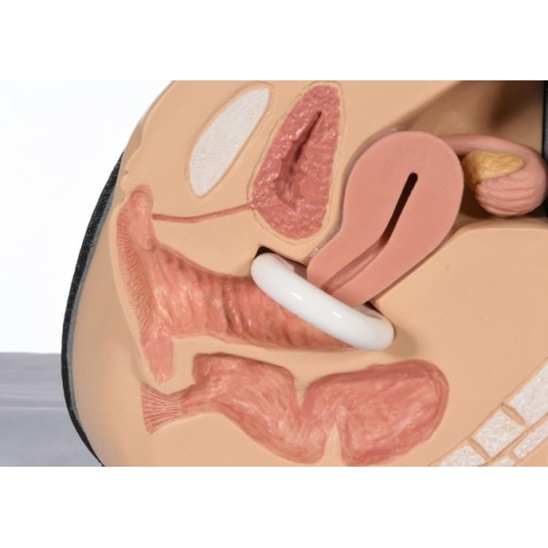 Inel Pessar tip Inelar - fara suport