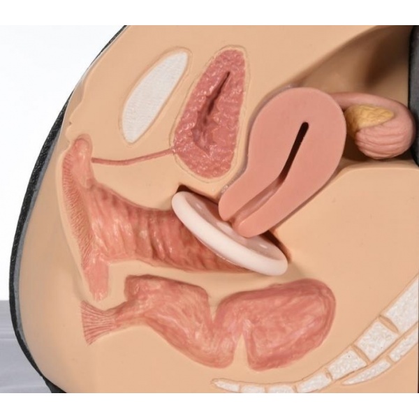 Inel Pessar tip Shaatz - cu dren