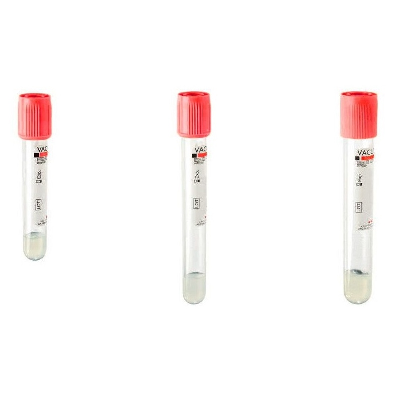 Vacutainer biochimie cu clot si gel separator 5 ml - 100 buc - Kima